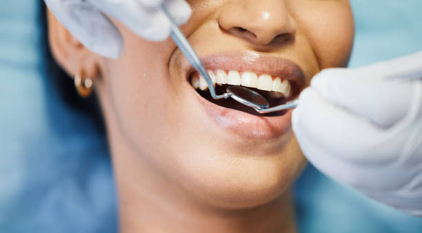Best Same-Day Emergency Dental Services in Ricardo, TX
