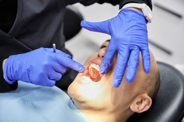Best Urgent Care for Lost Fillings or Crowns in Ricardo, TX